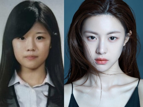 Go Youn Jung: "Nữ thần dao kéo" đẹp nhất xứ Hàn